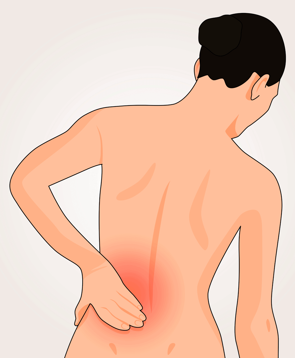 Rückenschmerzen durch Hexenschuss 